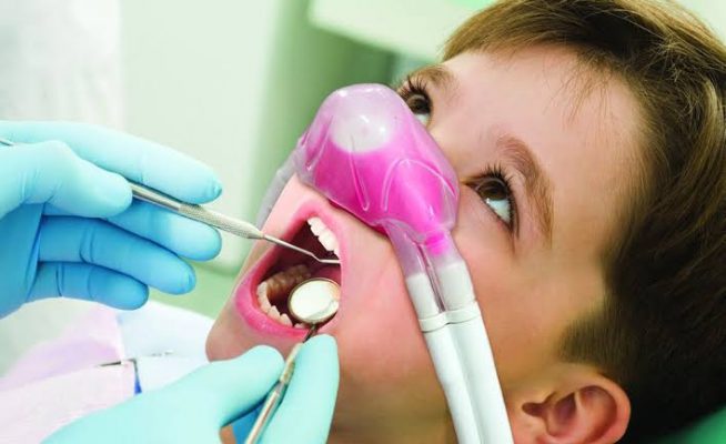 Laughing Gas  / Concious Sedation