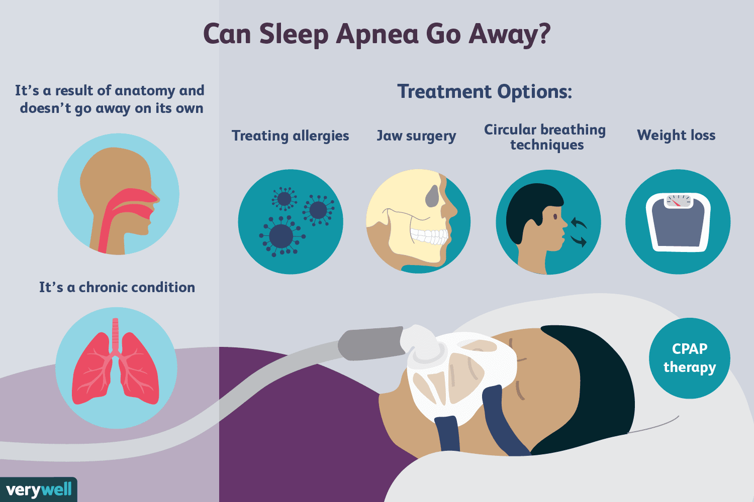 treatment of obstructive sleep apnea