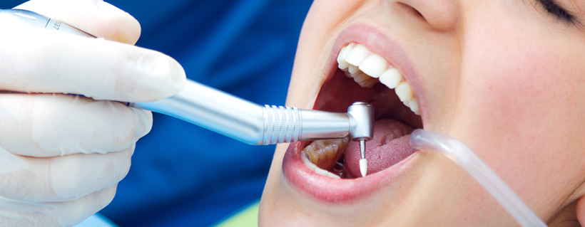 Why Choose Us for Dental Treatment