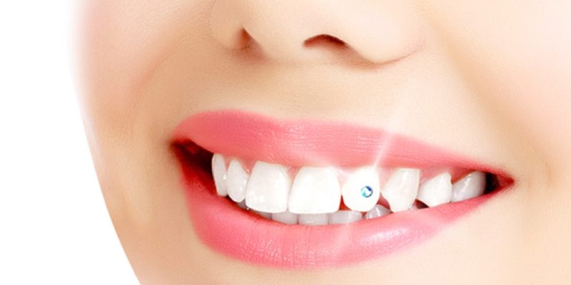 Tooth Jewellery dentist in vaishali
dental diamond in vaishali
diamonds in vaishali
teeth diamond in vaishali