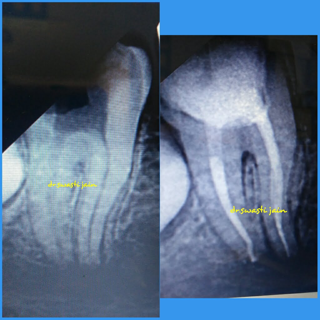 Dental X-Rays Dentist in Vaishali
tooth xray in vaishali ghaziabad 
dental xray in vaishali
digital dental xray in  vaishali