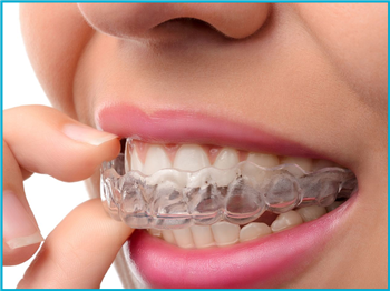 Best Orthodontic invisible Braces Treatment in Vaishali , Ghaziabad